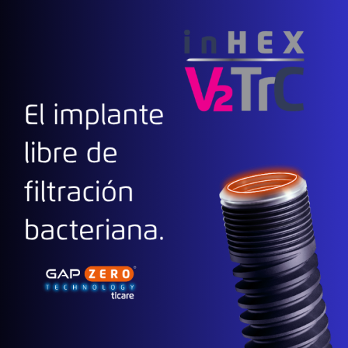 Comprar Implantes inHEX STD 3,75 mm
